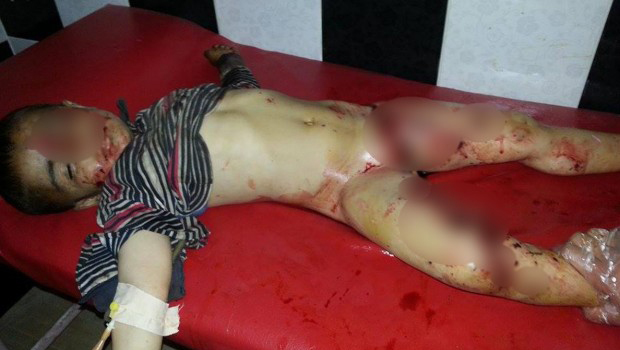 Kobane'de Mayın patladı, 2 çocuk ağır yaralı