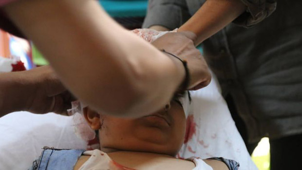 Cizre’de  2 çocuk daha hayatını kaybetti