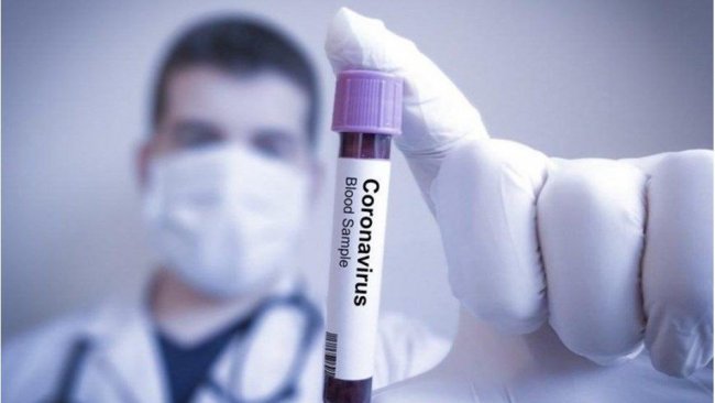 İtalya’dan açıklama: Koronavirüsü izole ettik