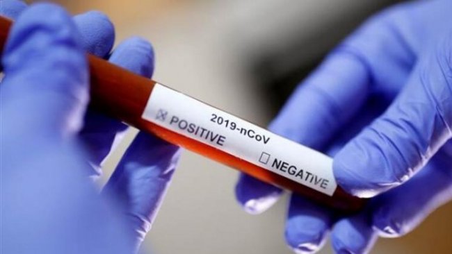 Haaretz’den koronavirüs iddiası: İsrail aşıyı buldu