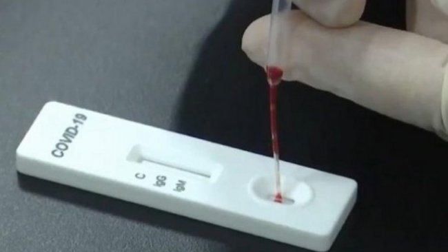 Çin'den gelen koronavirüs test kitleri çöpe gitti