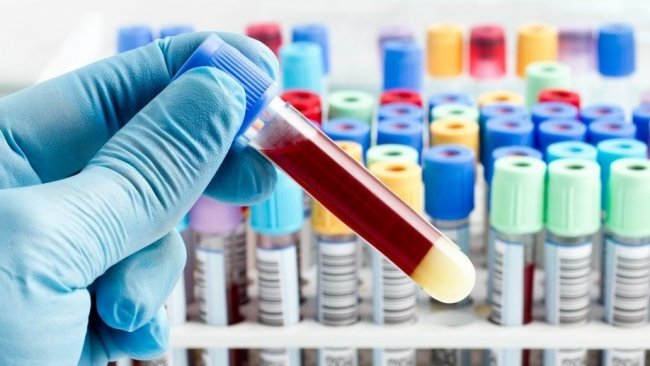 Yeni kan testi 50’den fazla kanser türünü ortaya çıkarabilir