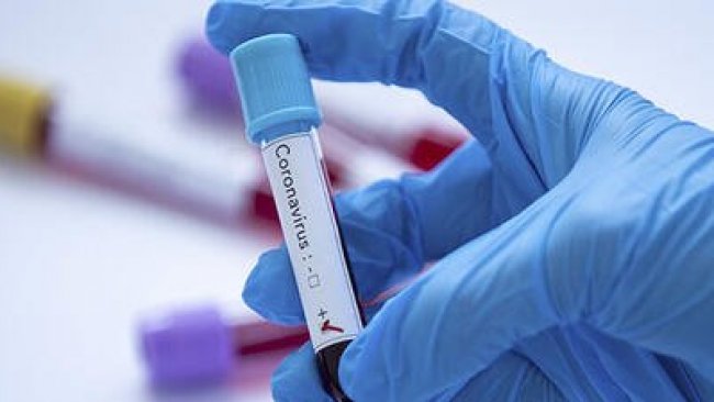 Dünya genelinde Koronavirüs vakası 1 milyon 100 bini aştı