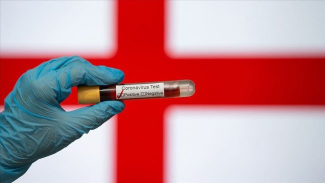 İngiltere, koronavirüs aşısını insanlar üzerinde denemeye başlıyor