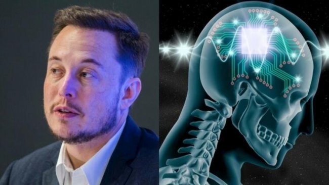 Elon Musk: Beyin çipiyle duyulamayan sesler duyulacak