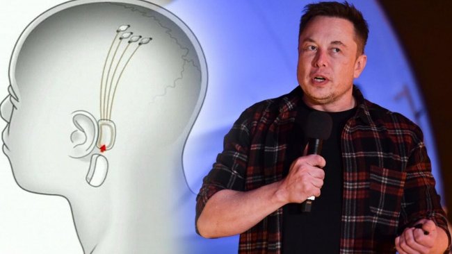 Elon Musk'ın beyin çipi insan üzerinde de denenecek