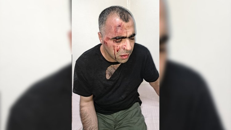 15 barodan gazeteci Sinan Aygül’e yönelik saldırıya kınama